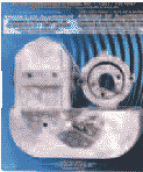 Aluminium Anodensatz Alpha-1-Gen II 1991
